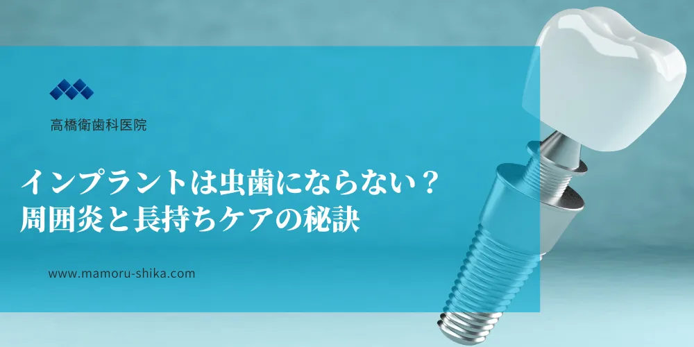 インプラントは虫歯にならない？周囲炎と長持ちケアの秘訣