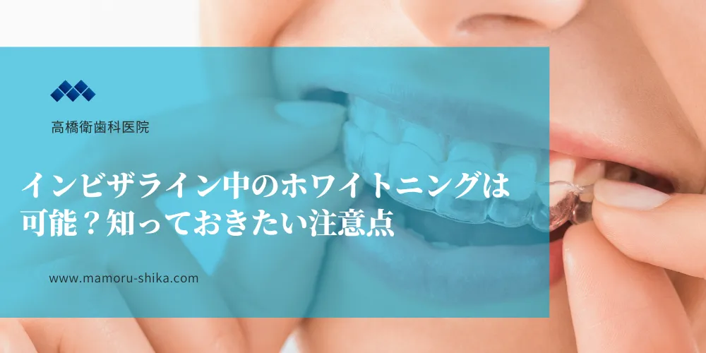 インビザライン中のホワイトニングは可能？知っておきたい注意点