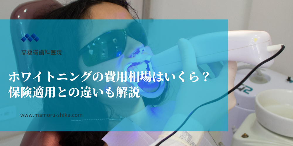 ホワイトニングの費用相場はいくら？保険適用との違いも解説
