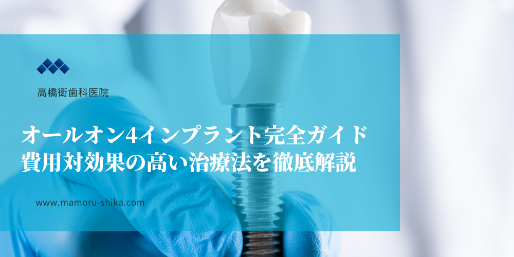 オールオン4インプラント完全ガイド：費用対効果の高い治療法を徹底解説