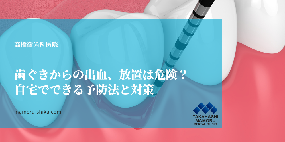 歯ぐきからの出血、放置は危険？自宅でできる予防法と対策