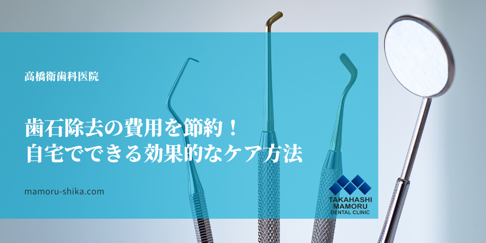 歯石除去の費用を節約！自宅でできる効果的なケア方法