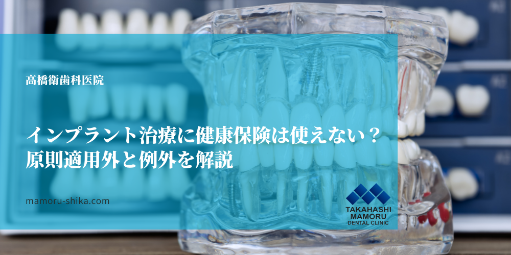 インプラント治療に健康保険は使えない？原則適用外と例外を解説