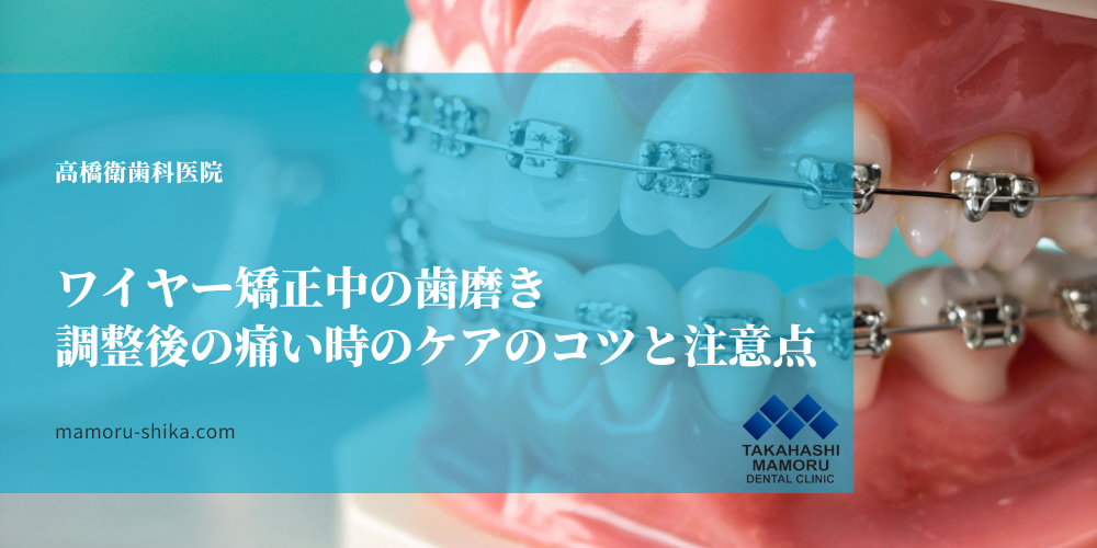 ワイヤー矯正中の歯磨き｜調整後の痛い時のケアのコツと注意点