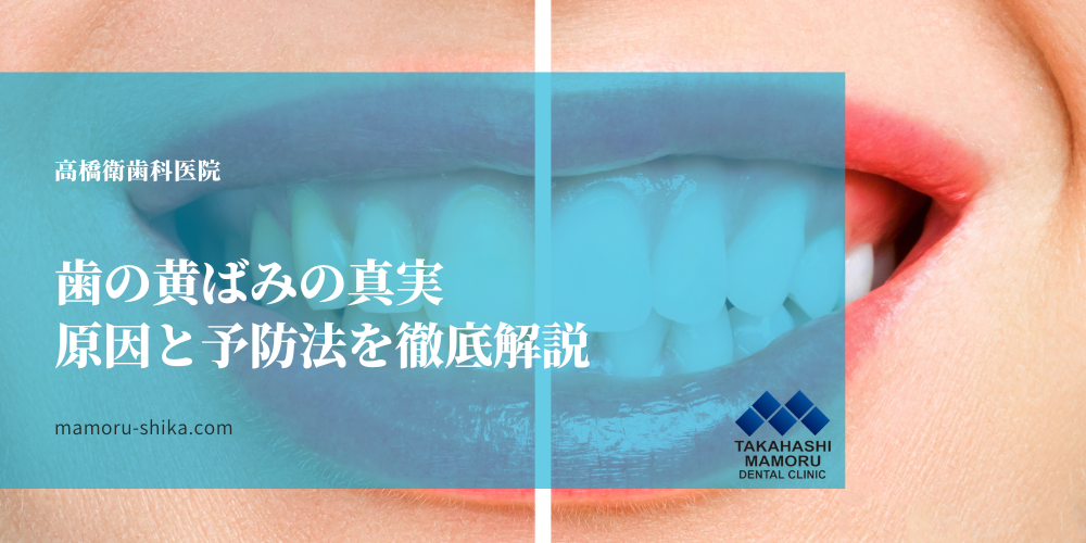 歯の黄ばみの真実：原因と予防法を徹底解説