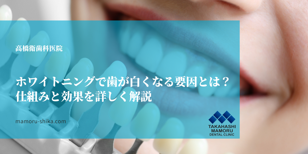 ホワイトニングで歯が白くなる要因とは？仕組みと効果を詳しく解説