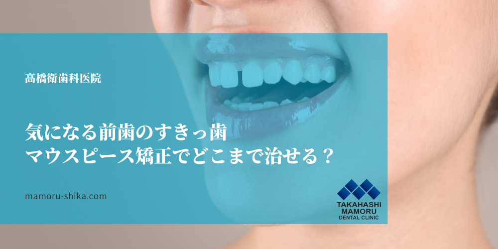 気になる前歯のすきっ歯、マウスピース矯正でどこまで治せる？