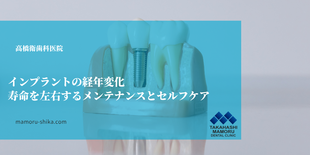 インプラントの経年変化｜寿命を左右するメンテナンスとセルフケア