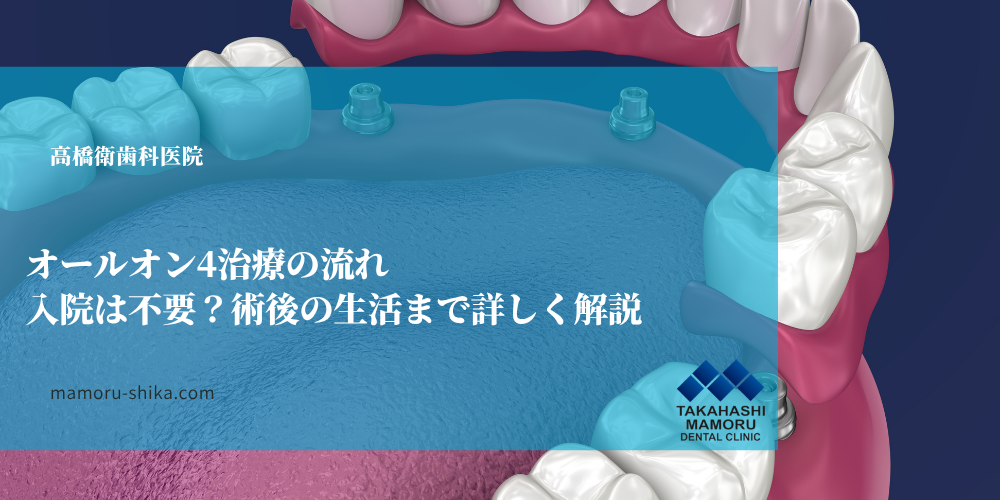 オールオン4治療の流れ｜入院は不要？術後の生活まで詳しく解説