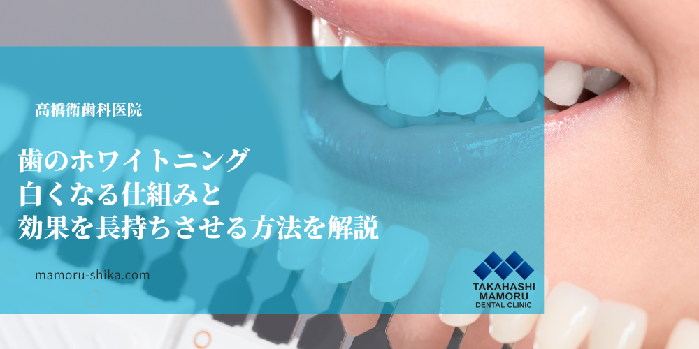 歯のホワイトニング｜白くなる仕組みと効果を長持ちさせる方法を解説