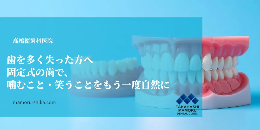 歯を多く失った方へ 固定式の歯で、 噛むこと・笑うことをもう一度自然に