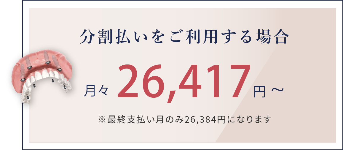 岩手県盛岡市の歯医者・インプラント歯科「高橋衛歯科医院」｜分割払いをご利用の場合の例