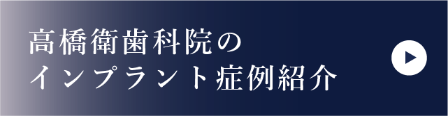 インプラント症例紹介