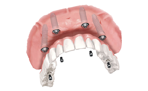 オールオン4のイメージ