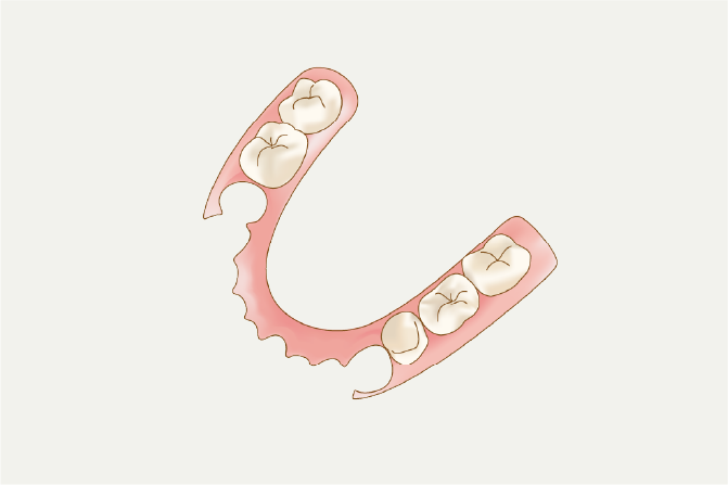 岩手県盛岡市の歯医者・インプラント歯科「高橋衛歯科医院」｜入れ歯イメージ