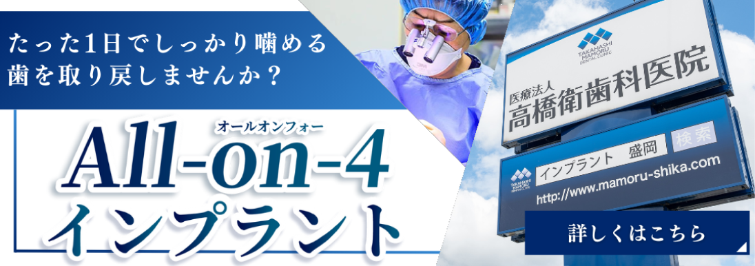 岩手県盛岡市の歯医者・インプラント歯科「高橋衛歯科医院」｜たった1日でしっかり噛める歯を取り戻しませんか？　ALL-On-4インプラント