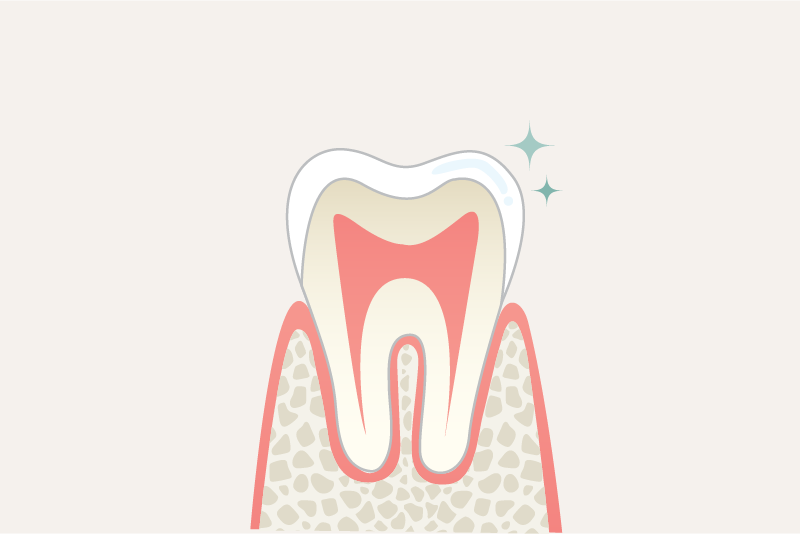 岩手県盛岡市の歯医者・インプラント歯科「高橋衛歯科医院」｜自費のジルコニアクラウンの汚れの付着イメージ