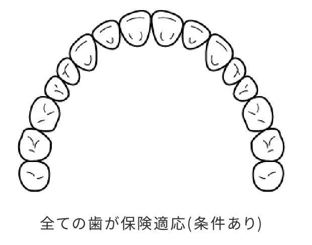 岩手県盛岡市の歯医者・インプラント歯科「高橋衛歯科医院」｜CAD/CAM冠（キャド/カムかん）