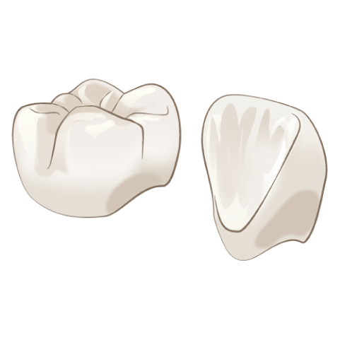 岩手県盛岡市の歯医者・インプラント歯科「高橋衛歯科医院」｜ジルコニアインレー/クラウン