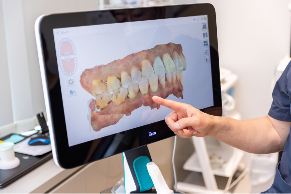 岩手県盛岡市の歯医者・インプラント歯科「高橋衛歯科医院」｜口腔内スキャナーで簡易診断するところ