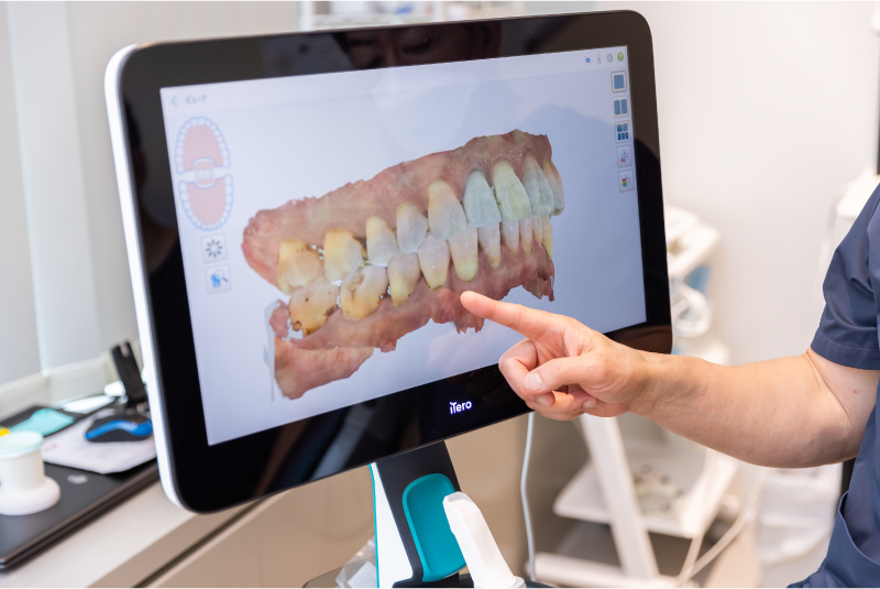 岩手県盛岡市の歯医者・インプラント歯科「高橋衛歯科医院」｜iTeroを使ってお口の中をスキャンしたデータからシミュレーションを説明する様子