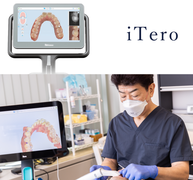 岩手県盛岡市の歯医者・インプラント歯科「高橋衛歯科医院」｜iTeroを使ってお口の中をスキャンする様子
