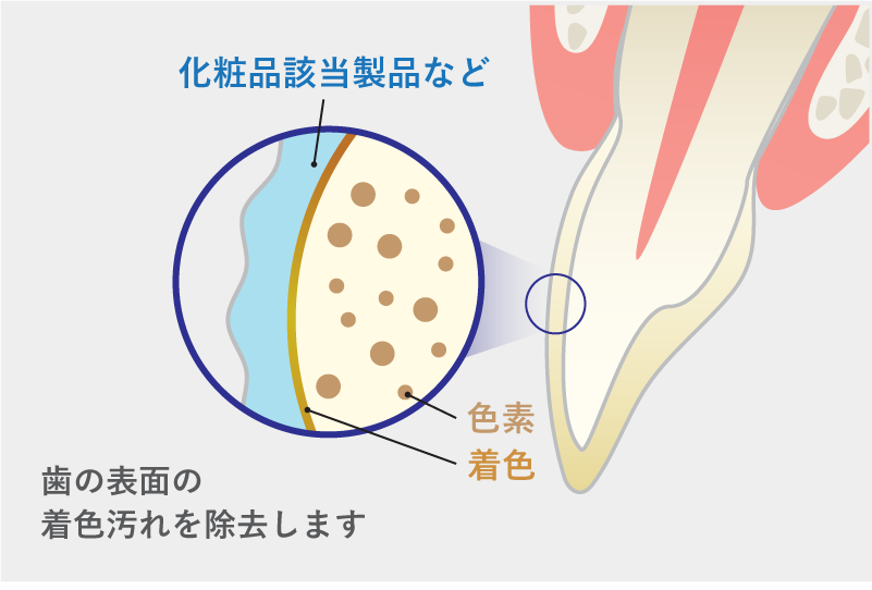 岩手県盛岡市の歯医者・インプラント歯科「高橋衛歯科医院」｜非医療ホワイトニングでは歯の表面の着色汚れを除去できるイメージ