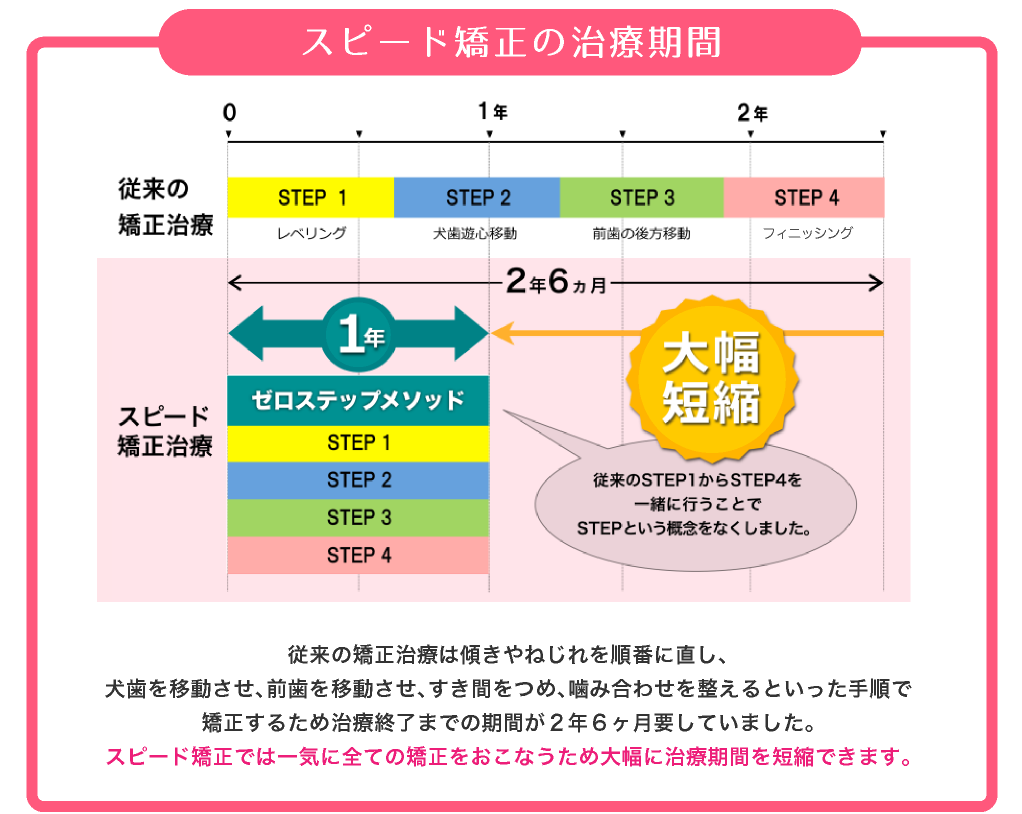 スピード矯正の治療期間