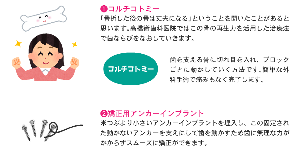 ❶コルチコトミー
「骨折した後の骨は丈夫になる」ということを聞いたことがあると思います。高橋衛歯科医院ではこの骨の再生力を活用した治療法で歯ならびをなおしていきます。❷矯正用アンカーインプラント
米つぶより小さいアンカーインプラントを埋入し、この固定された動かないアンカーを支えにして歯を動かすため歯に無理な力がかからずスムーズに矯正ができます。