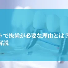 インプラントで抜歯が必要な理由とは？ケース別に解説