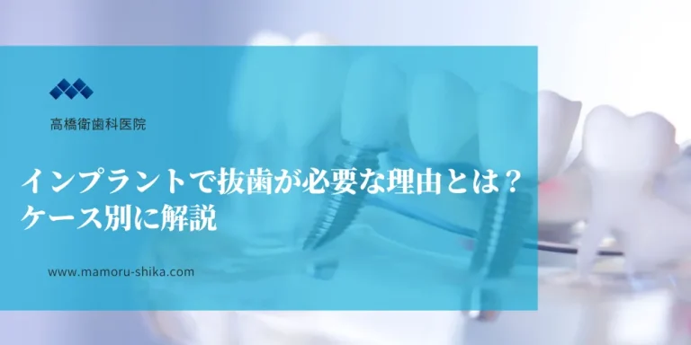 インプラントで抜歯が必要な理由とは？ケース別に解説